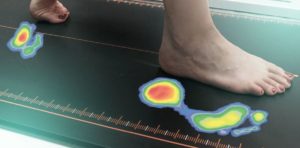 foot analysis