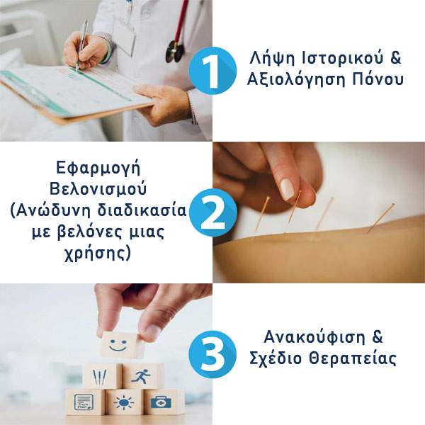 Διαδικασία Βελονισμού